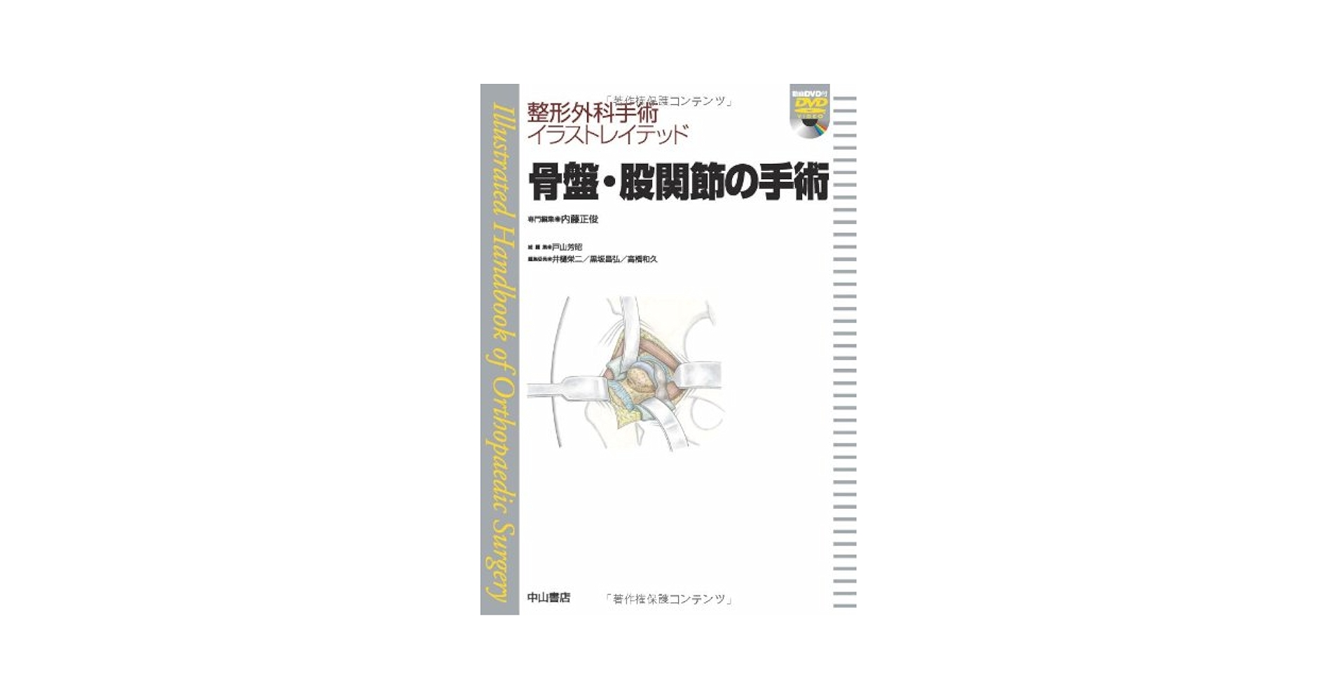 整形外科手術イラストレイテッド 膝関節の手術　中山書店 41VCg2k+XYL.jpg